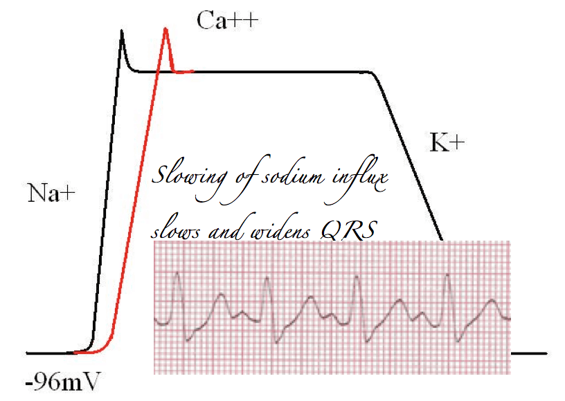 Electrolytes And The Heart Resus