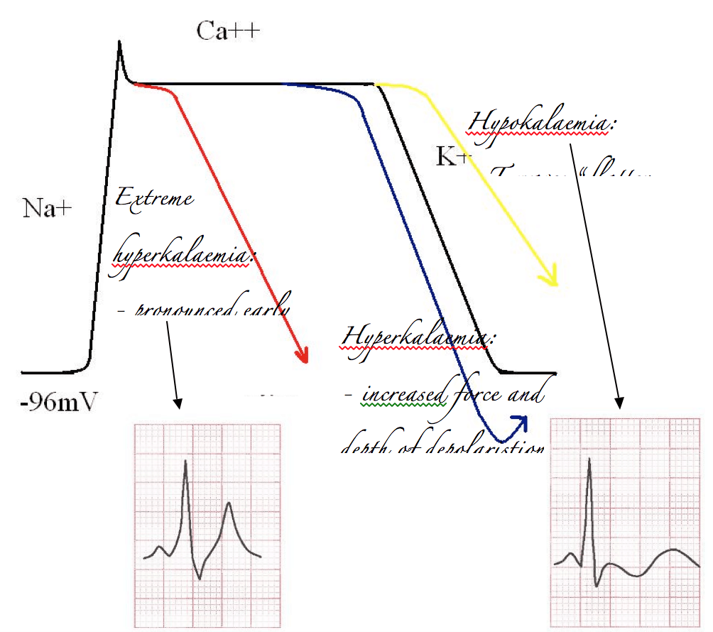 Electrolytes and the heart