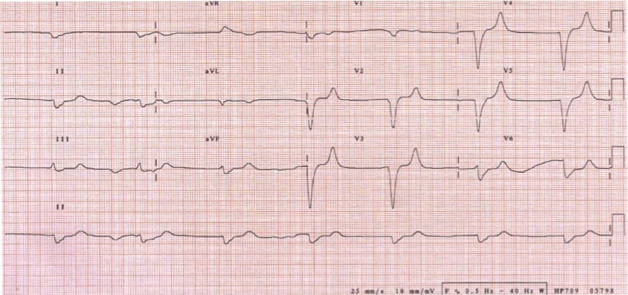 80 year old male found on the floor