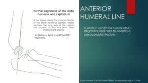Anterior Humeral Line