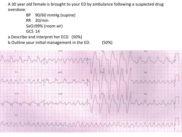 ECG - RESUS - Emergency Medicine Education