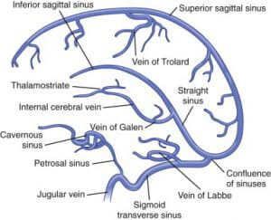 Cerebral Venous Thrombosis Resus