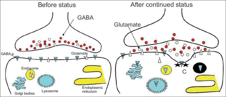 Pathophysiology Of Status Epilepticus