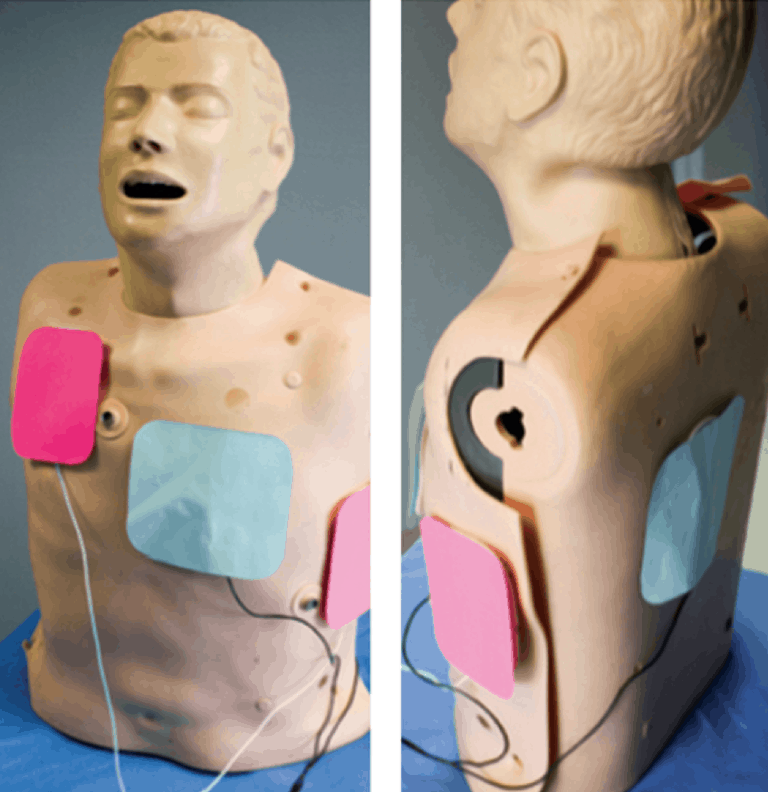 sequential defibrillation