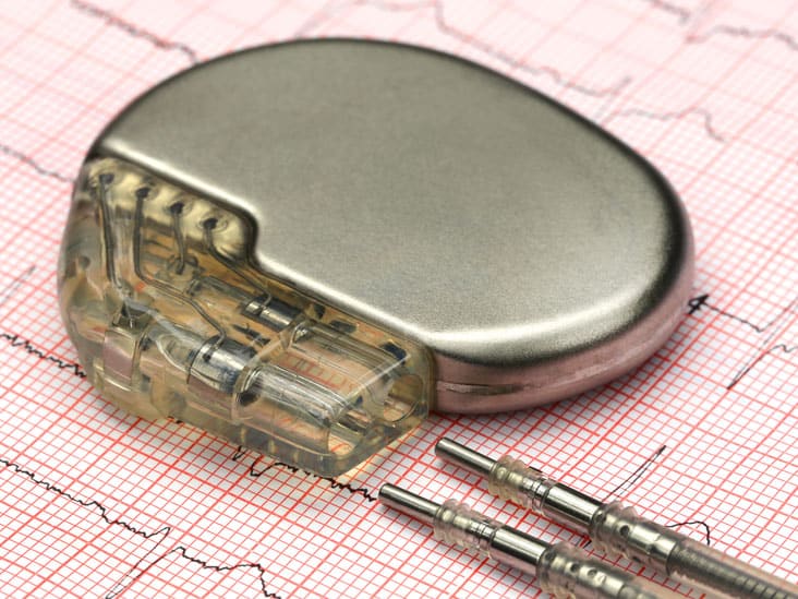 Runaway Pacemaker and Lethal Arrhythmia