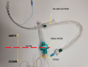 Intubation - SARS-CoV-2