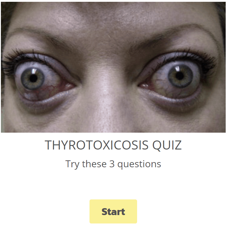 Thyrotoxicosis Quiz