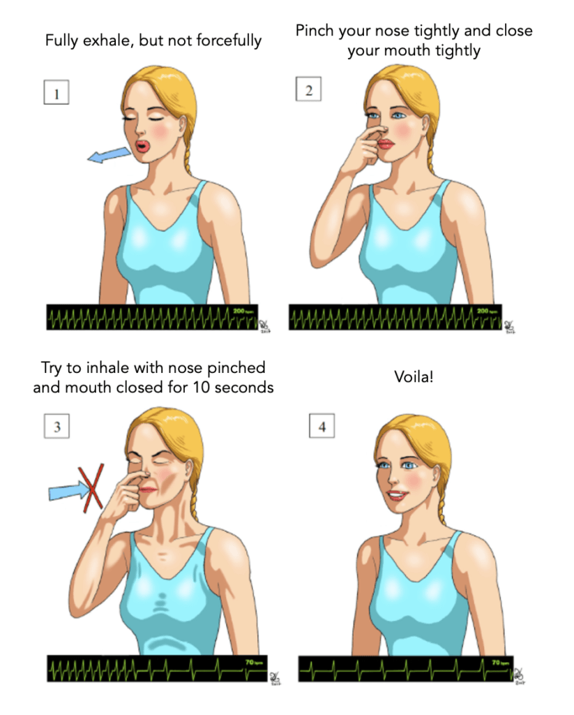 The Reverse Vagal Manoeuvre for SVT | Resus