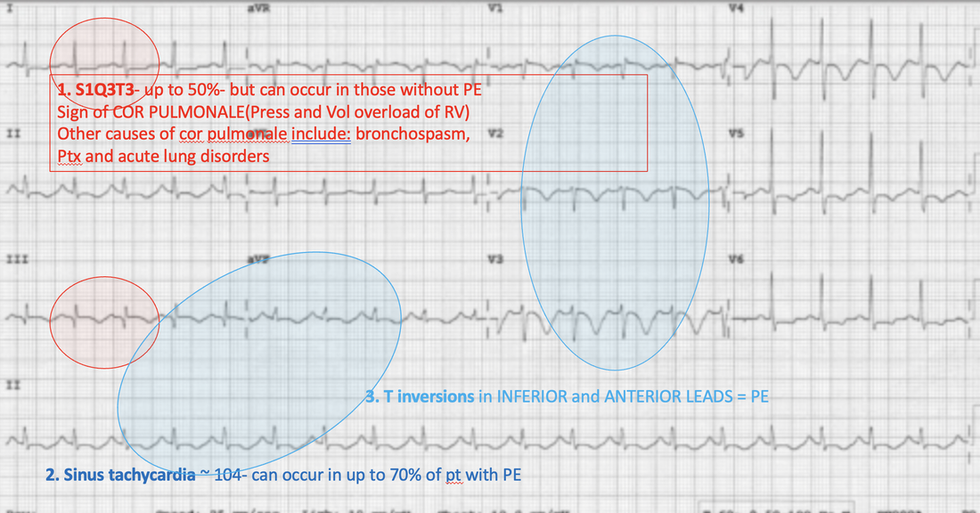 ECG 1 Answer