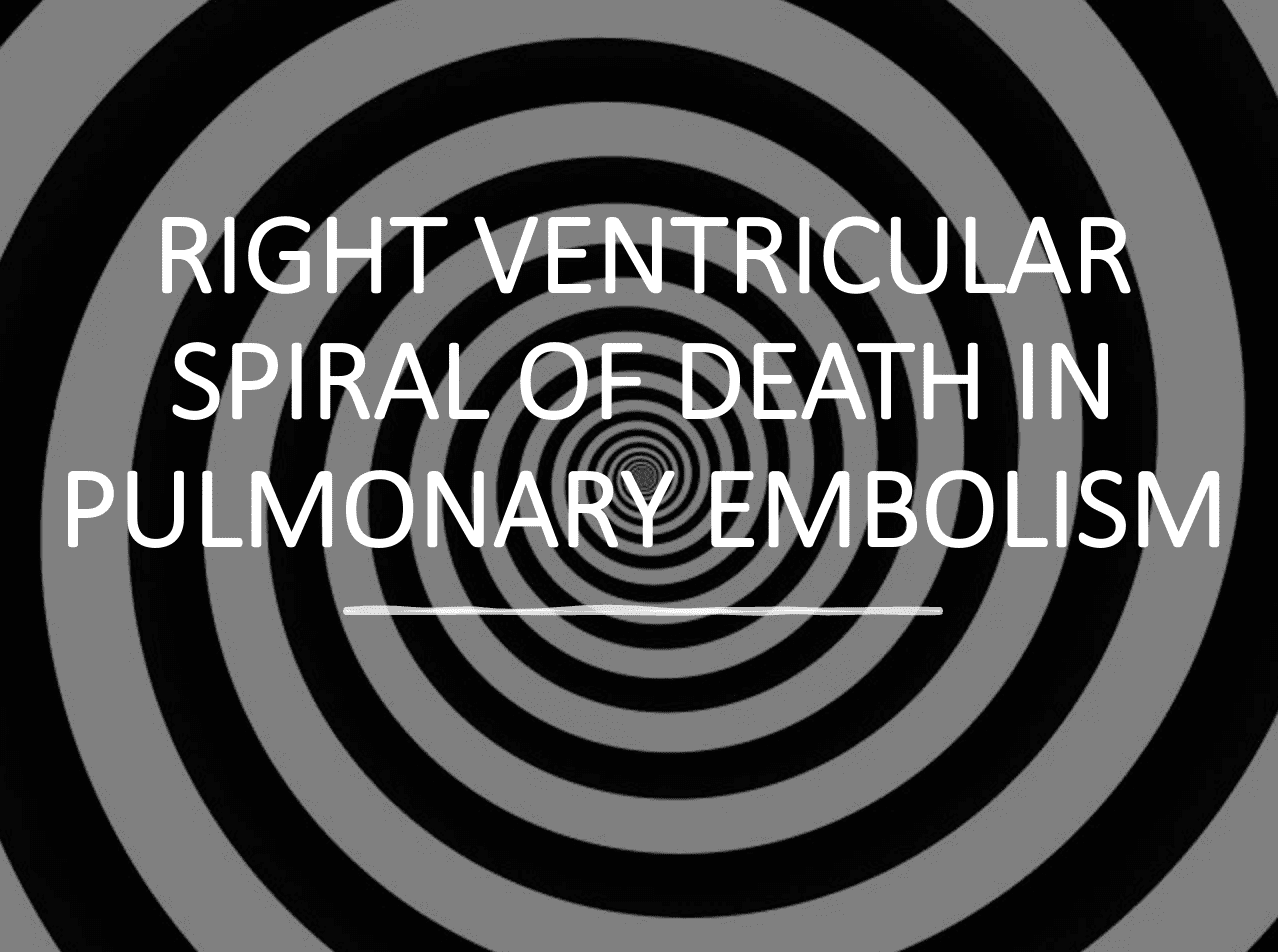 The Right Ventricular Spiral of Death