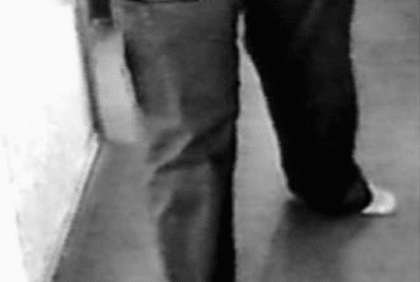 Hoover's Sign and Functional Weakness