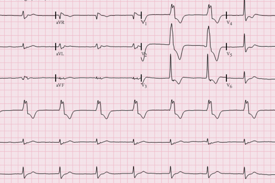 ECG Of The Week Category | Emergency Medicine | Resus