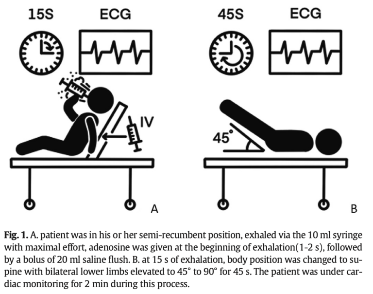 Modified Valsalva plus Adenosine for reverting SVT | Resus