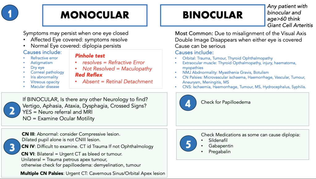 5 Steps to Diagnosing Diplopia | Resus