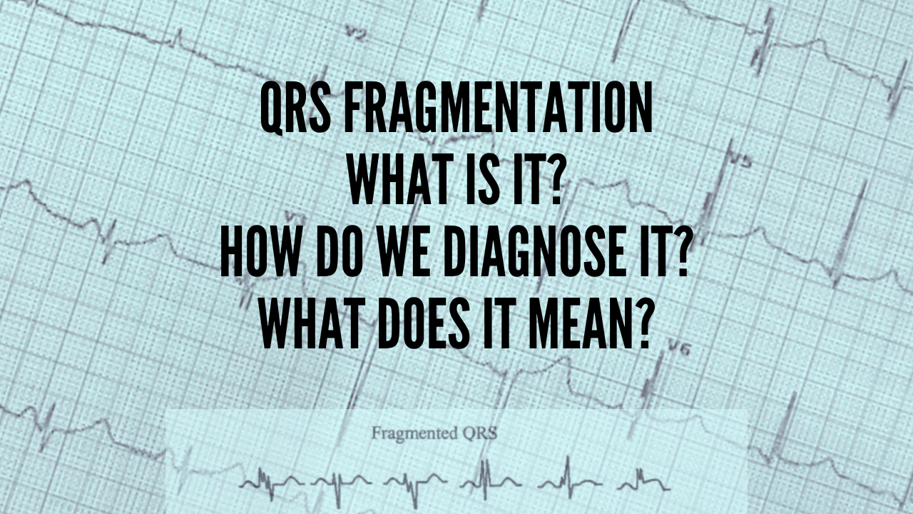 The Fragmented QRS