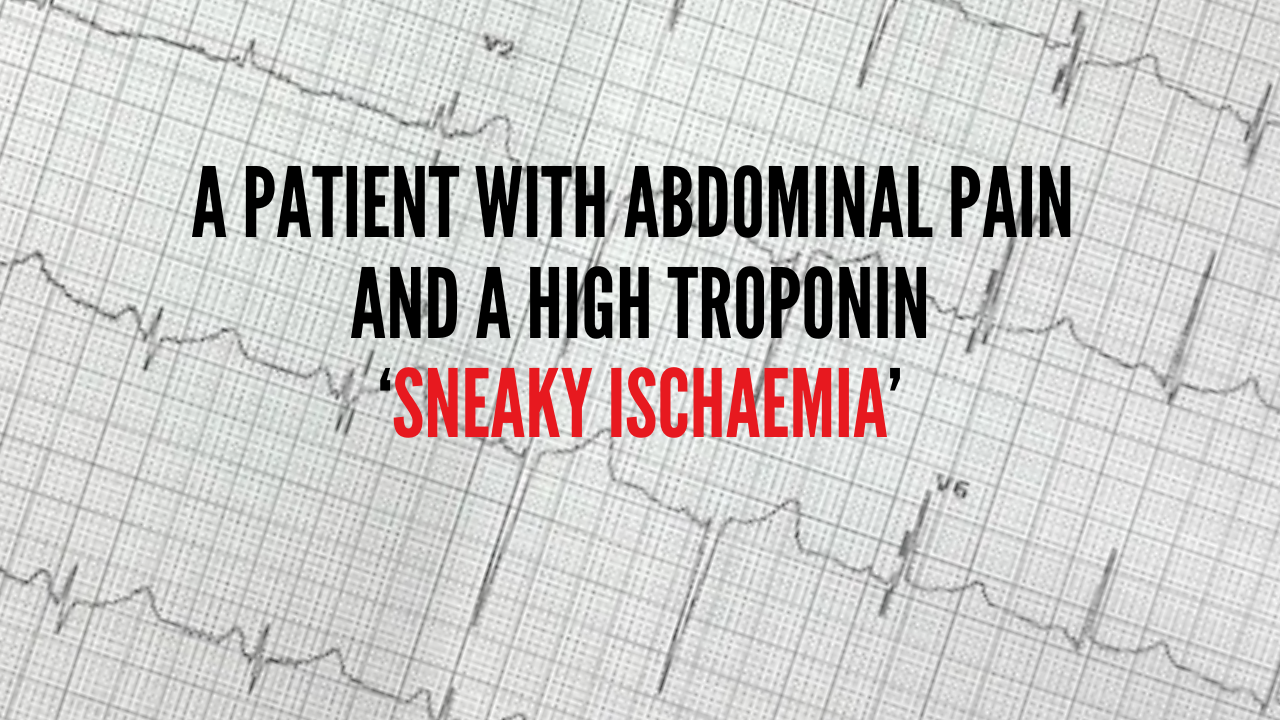 A patient with Abdominal Pain