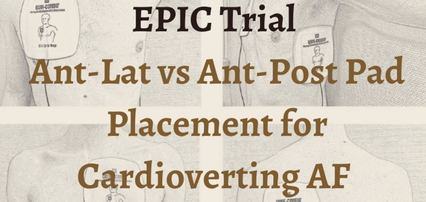 EPIC Trial: Pad placement for AF Cardioversion