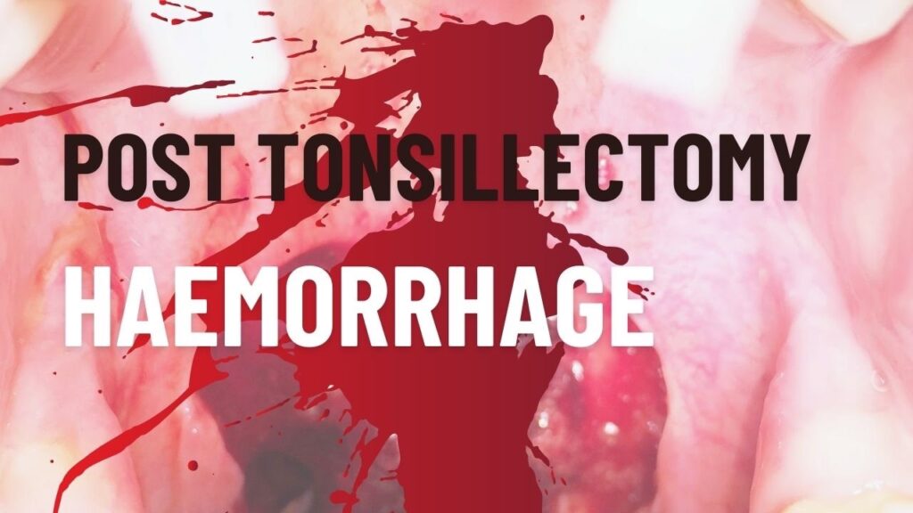 4df8f1a-7566-8dd0-f355-d8eafedf44d0_61a2571e-588e-48c2-833a-ccaca46eb6c5