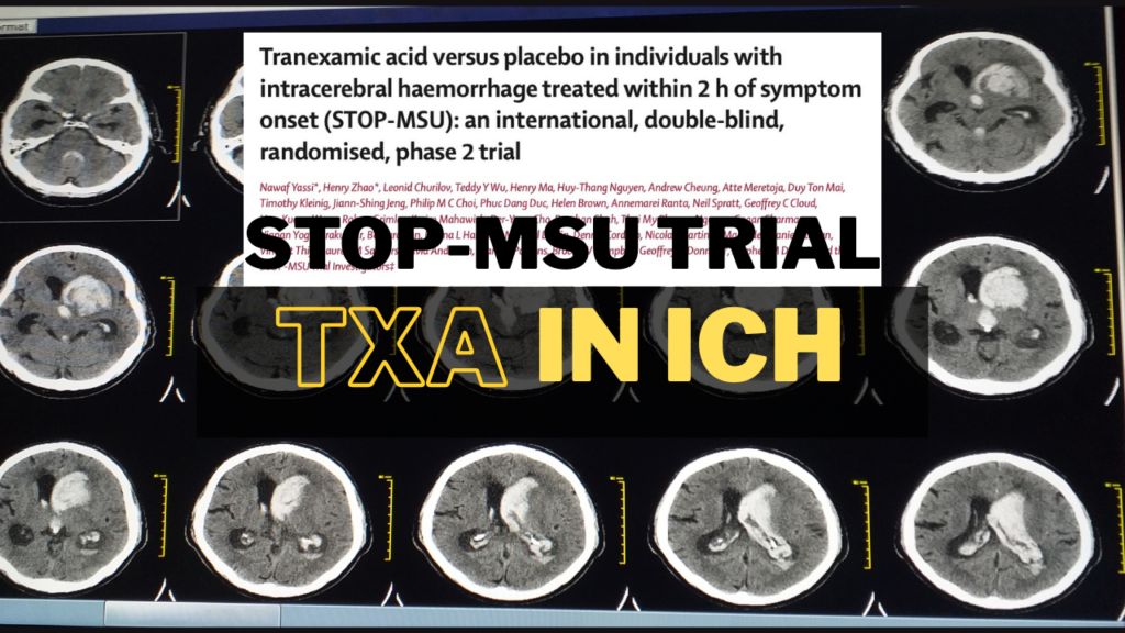 transient global amnesia australia