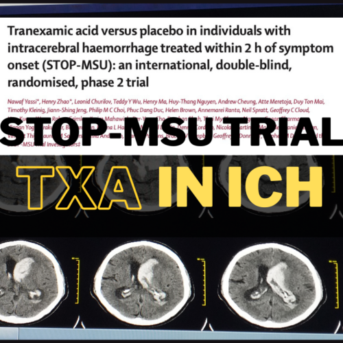 transient global amnesia australia