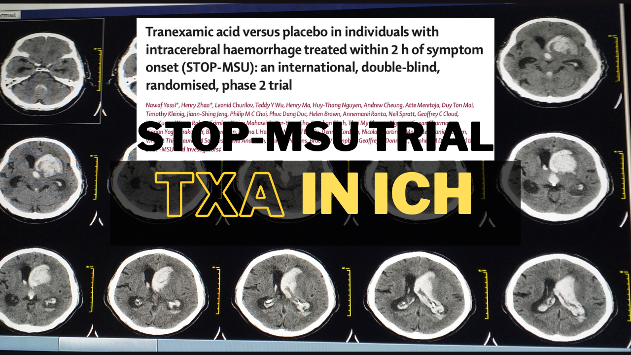 The STOP-MSU Trial